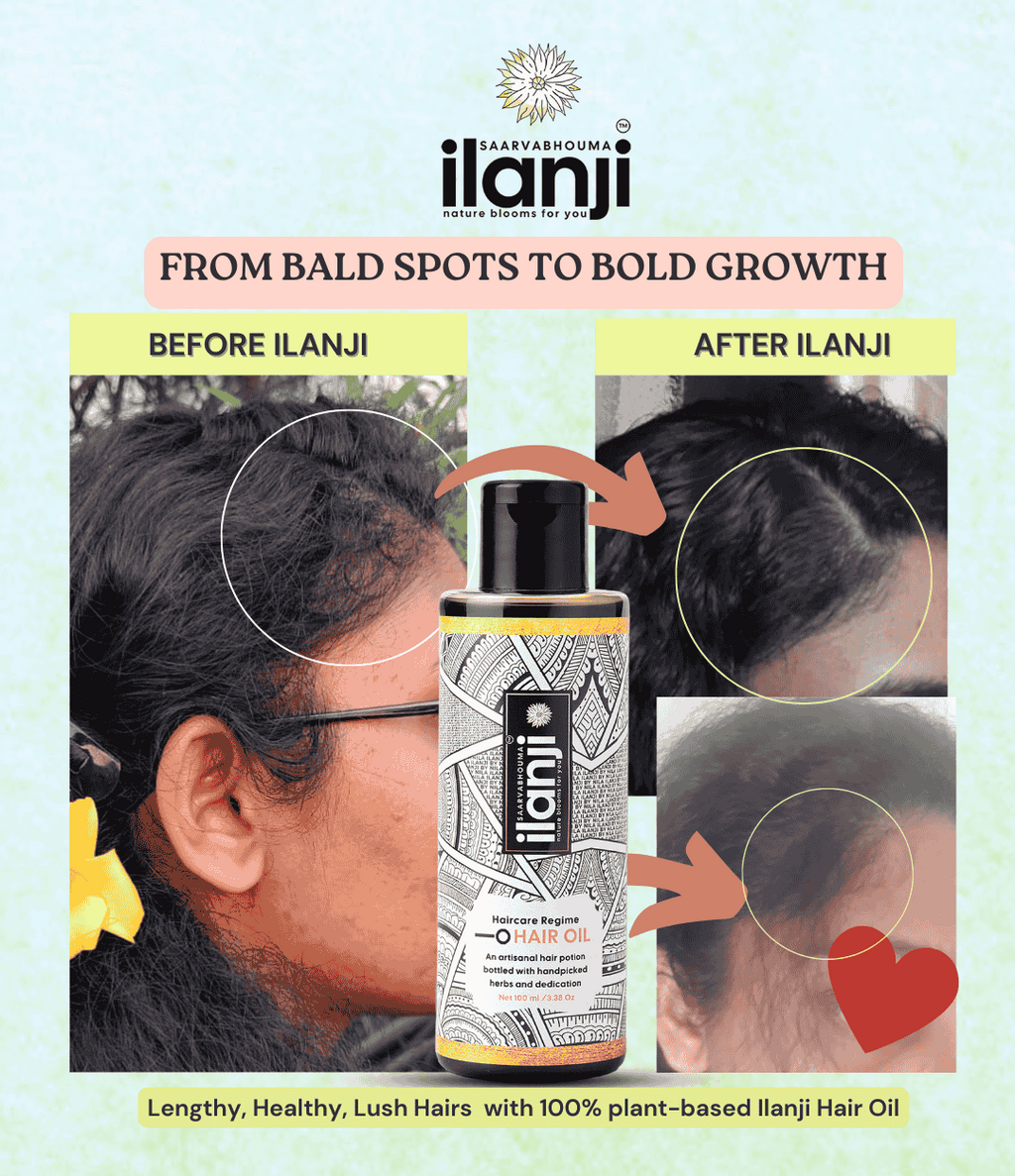 Saarvabhouma Ilanji Hair Oil