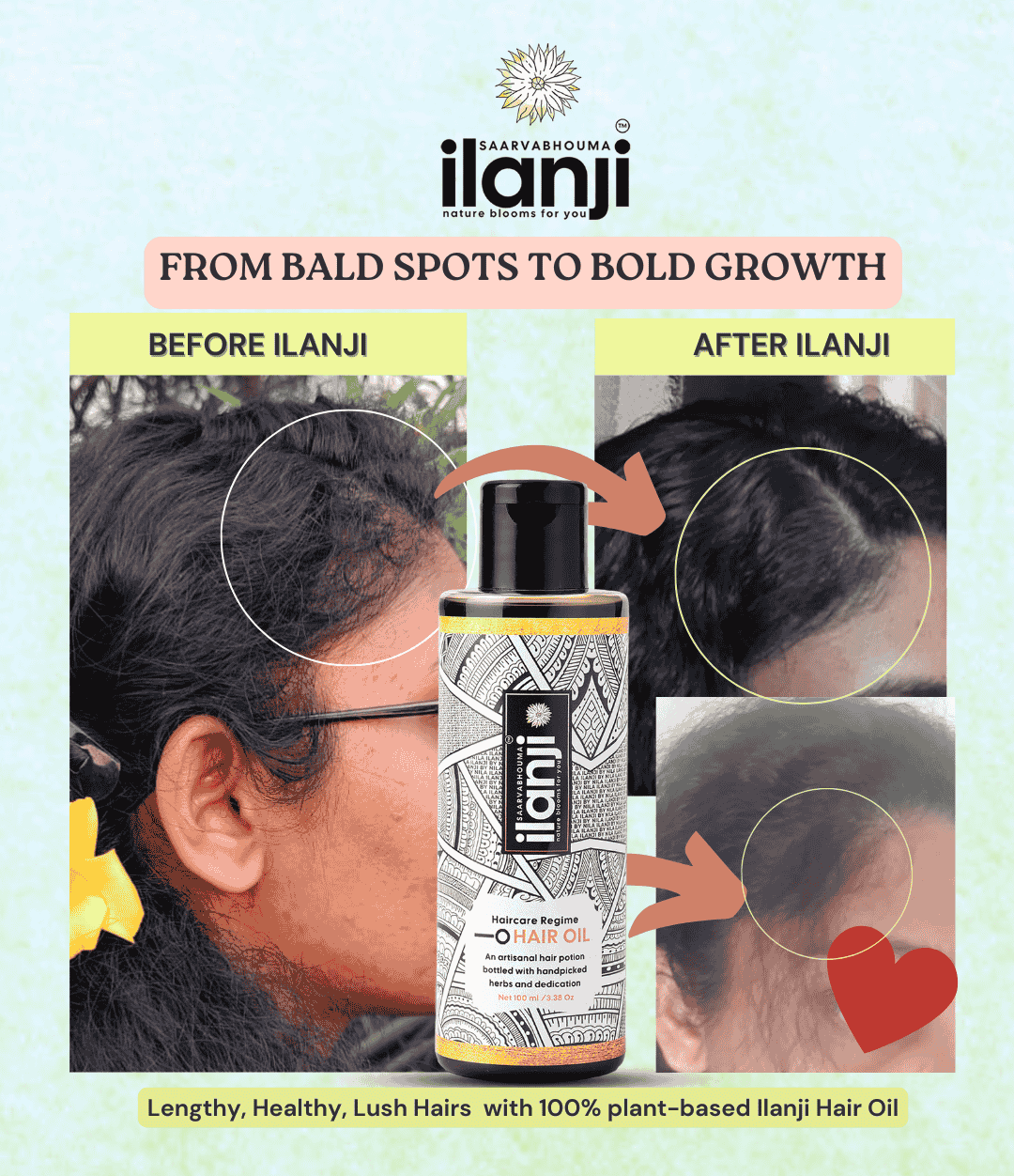 Saarvabhouma Ilanji Hair Oil