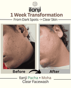 Ilanji Pacha & Moha Facewash