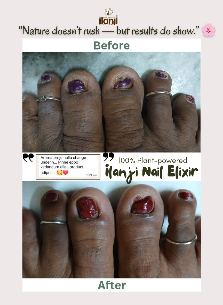 Ilanji Nail Elixir