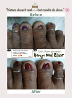 Ilanji Nail Elixir