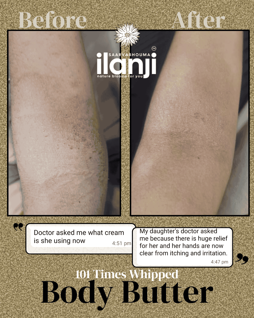 Ilanji 100 Times Whipped Body Butter