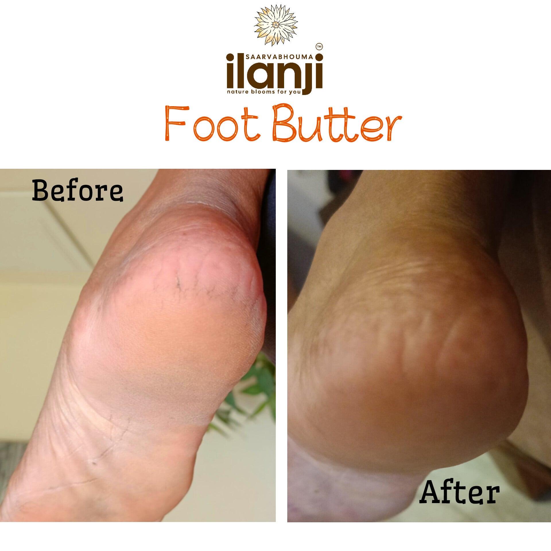 Ilanji Foot Butter