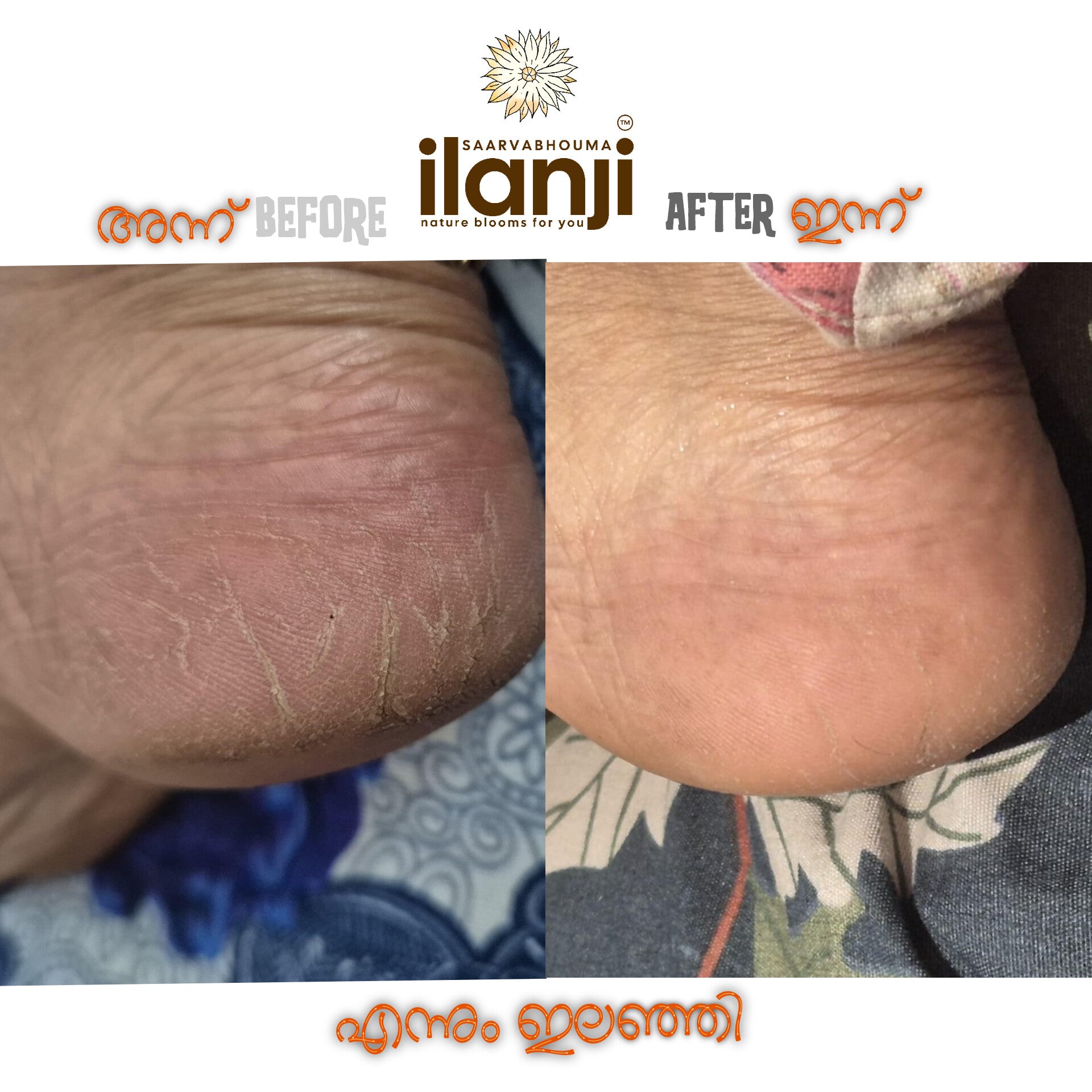 Ilanji Foot Butter